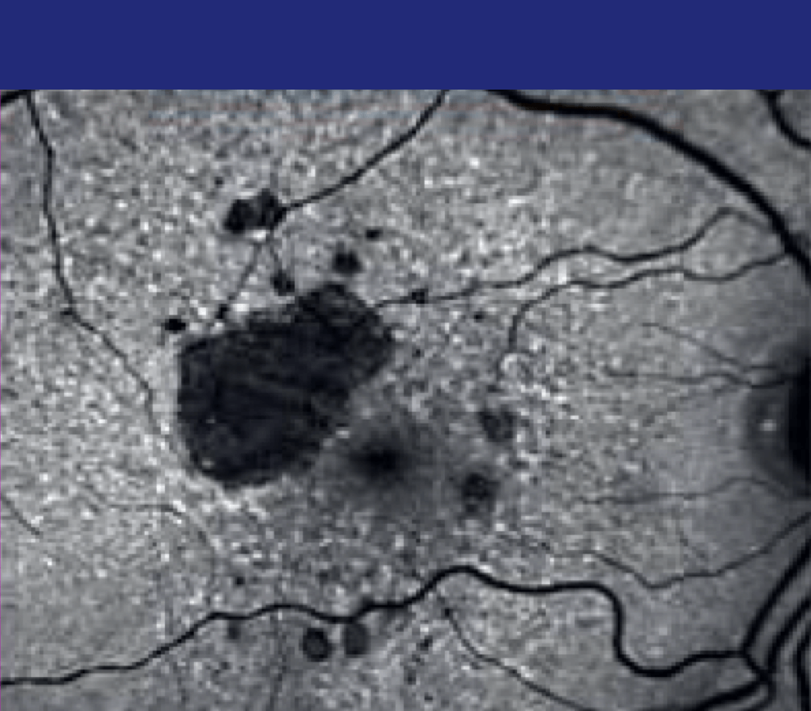 +1 Years<sup>&Dagger;</sup>