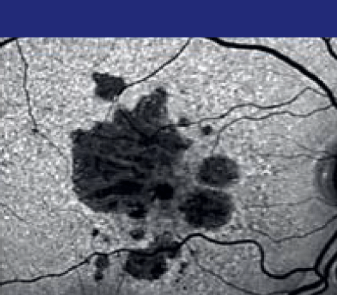 +3 Years<sup>&Dagger;</sup>