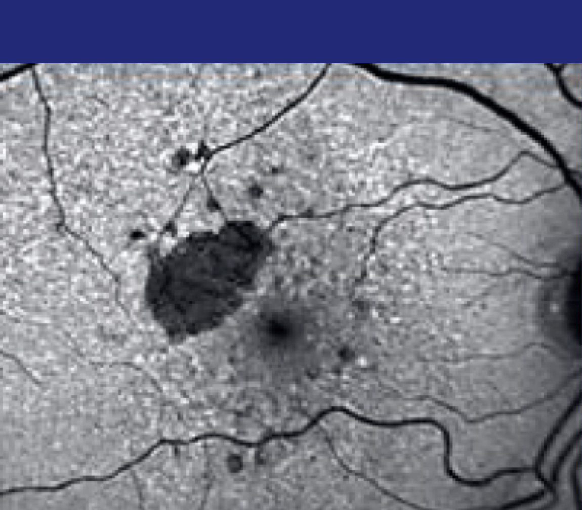 Baseline<sup>&Dagger;</sup>